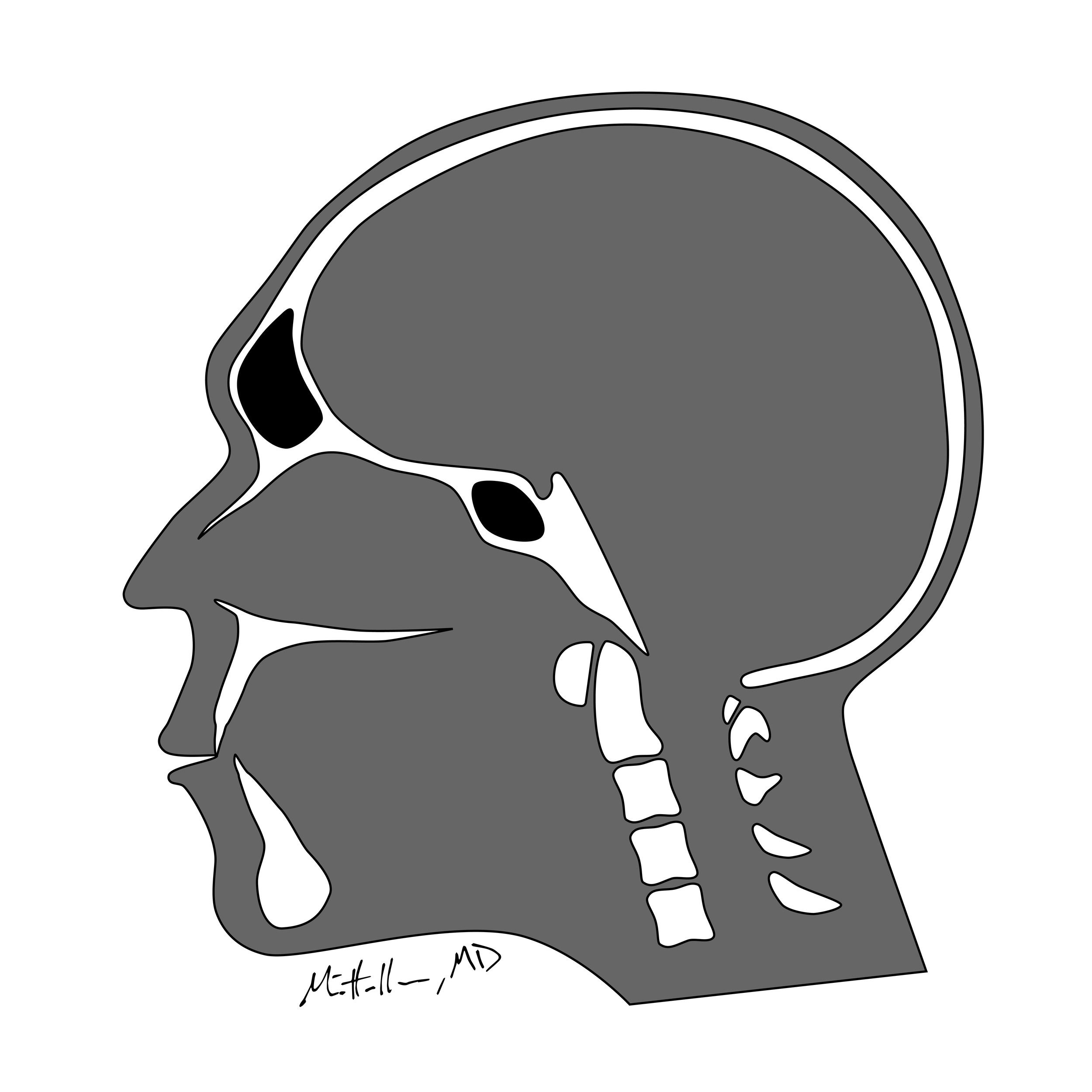 type 3 forehead illustration